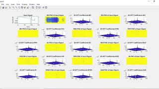 Celebrity MULTICLASS EPILEPTIC SEIZURE CLASSIFICATION USING TIME-FREQUENCY ANALYSIS OF EEG SIGNALS USING DFT Net Worth