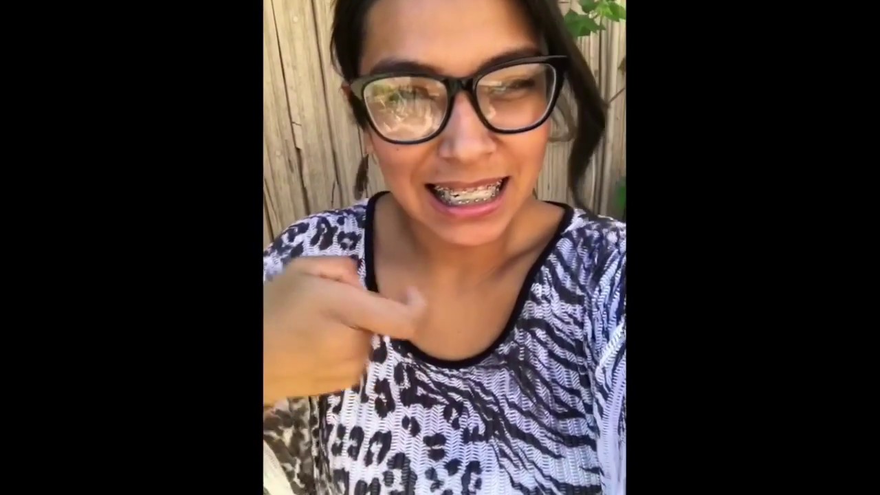 Rubber Bands! ASL Braces Update YouTube