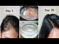 Aloevera Flaxseed Gel for Hair Growth - Long hair & Turn Thin Hair to Thick Hair in 30 Days