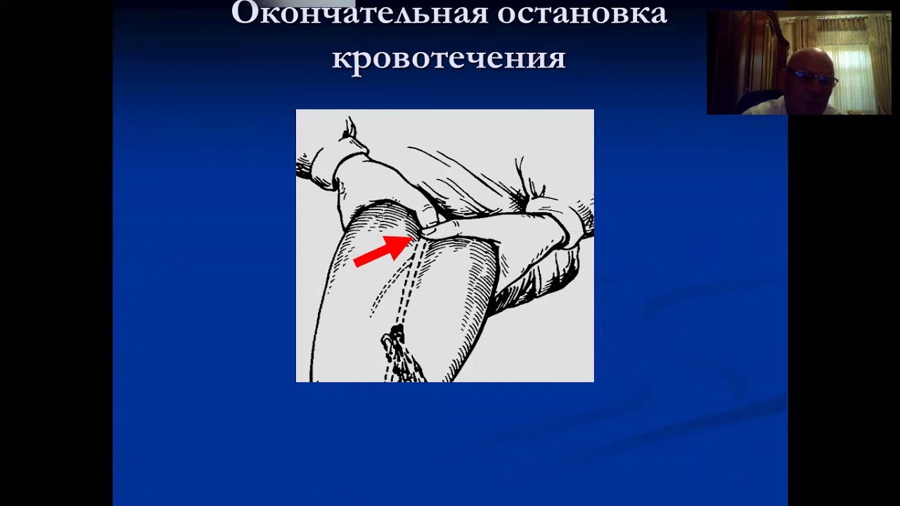 РАНЕНИЯ МАГИСТРАЛНЫХ СОСУДОВ