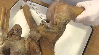 Соединения костей таза (2 часть) и нижней конечности