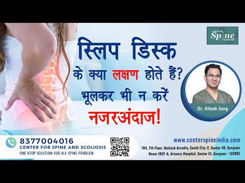 वीडियो: हर्नियेटेड डिस्क दर्द कहाँ महसूस होता है?