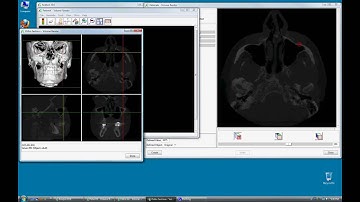 Volume Render Fabricate Tool - Creating Landmarks