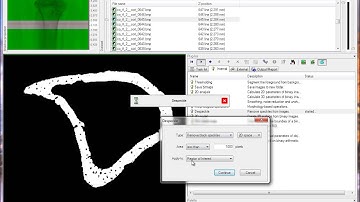 Cortical bone 2: porosity