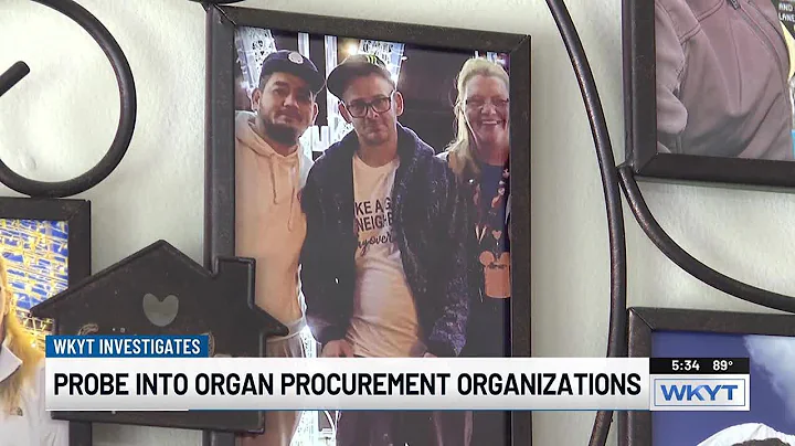 Federal changes prompted by Ky. man’s failed organ retrieval surgery