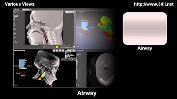 Various  functions of VX3D, the 3D CT volume rendering SW of 3DII