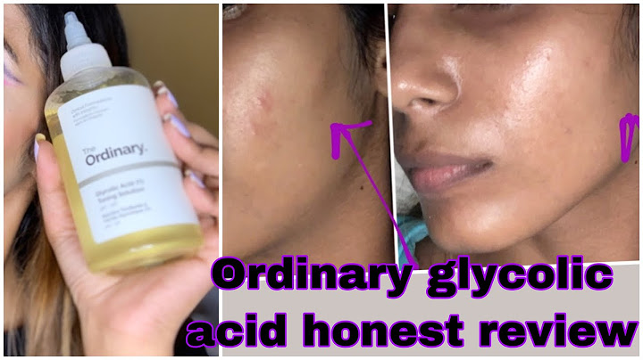 The ordinary glycolic acid toner review before and after