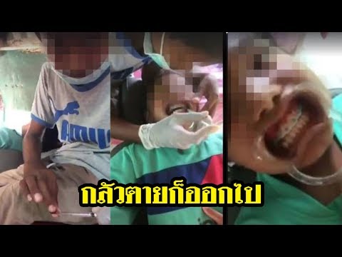 วิจารณ์หนัก!! เด็กไลฟ์สดจัดฟันเถื่อน | 13-06-60 | ThairathTV