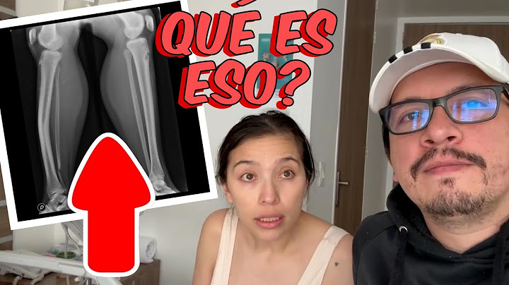 The Biggest Scares of Our Lives😭💔 - A Mass on His Leg? I Paulis & Mauro