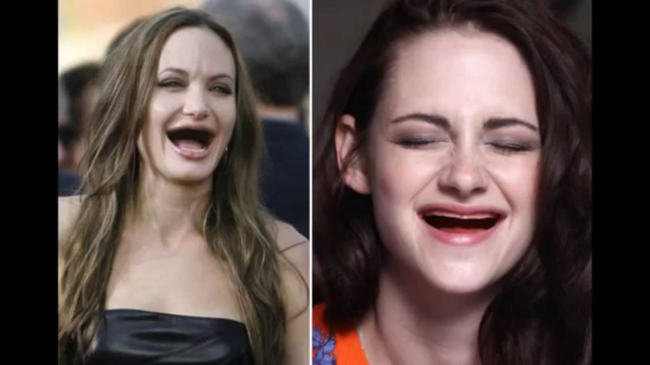 celebrities without eyebrows and teeth