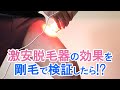 超激安の脱毛器は効果があるのか？剛毛で検証 #shorts