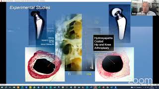 HydroxyApatite Coated Implants in Hip and Knee Arthroplasty