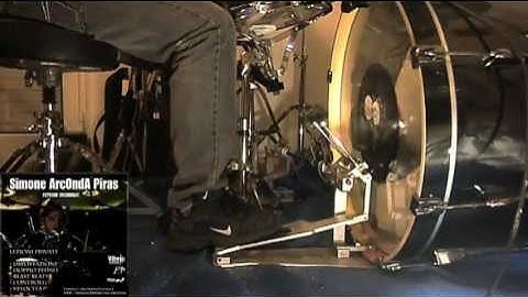 Swivel Technique -  Axis Al2 - ArcOndA Foot Cam