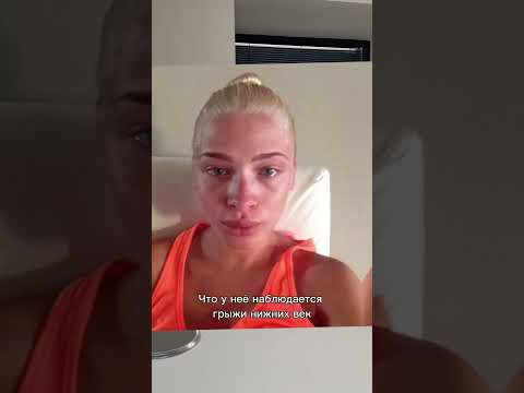 Video: Alena Shishkova: voor en na die operasie