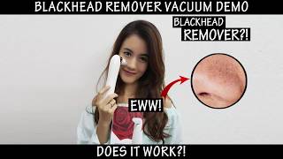 Premium Blackhead Remover Vacuum Suction Device Pore Clean Machine Review 003