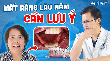 Mất Răng Lâu Năm: Trồng Implant Được Không? Mất Răng Lâu Năm Nhất Định Lưu Ý Điều Này!