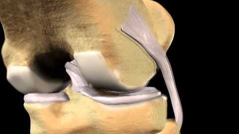 ACL Animation Sample