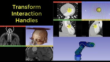 Transform Interaction Handles in 3D Slicer