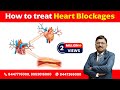How to treat Heart blockages