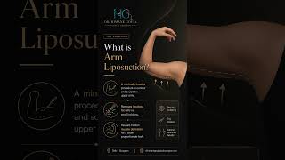 Arm Liposuction | Delhi & Gurugram #drhimankgoyalplasticsurgeon