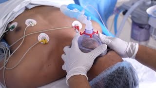 General Anesthesia for a young  Boy