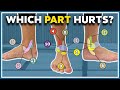 My ankle hurts here 11 typical pain spots and what they mean