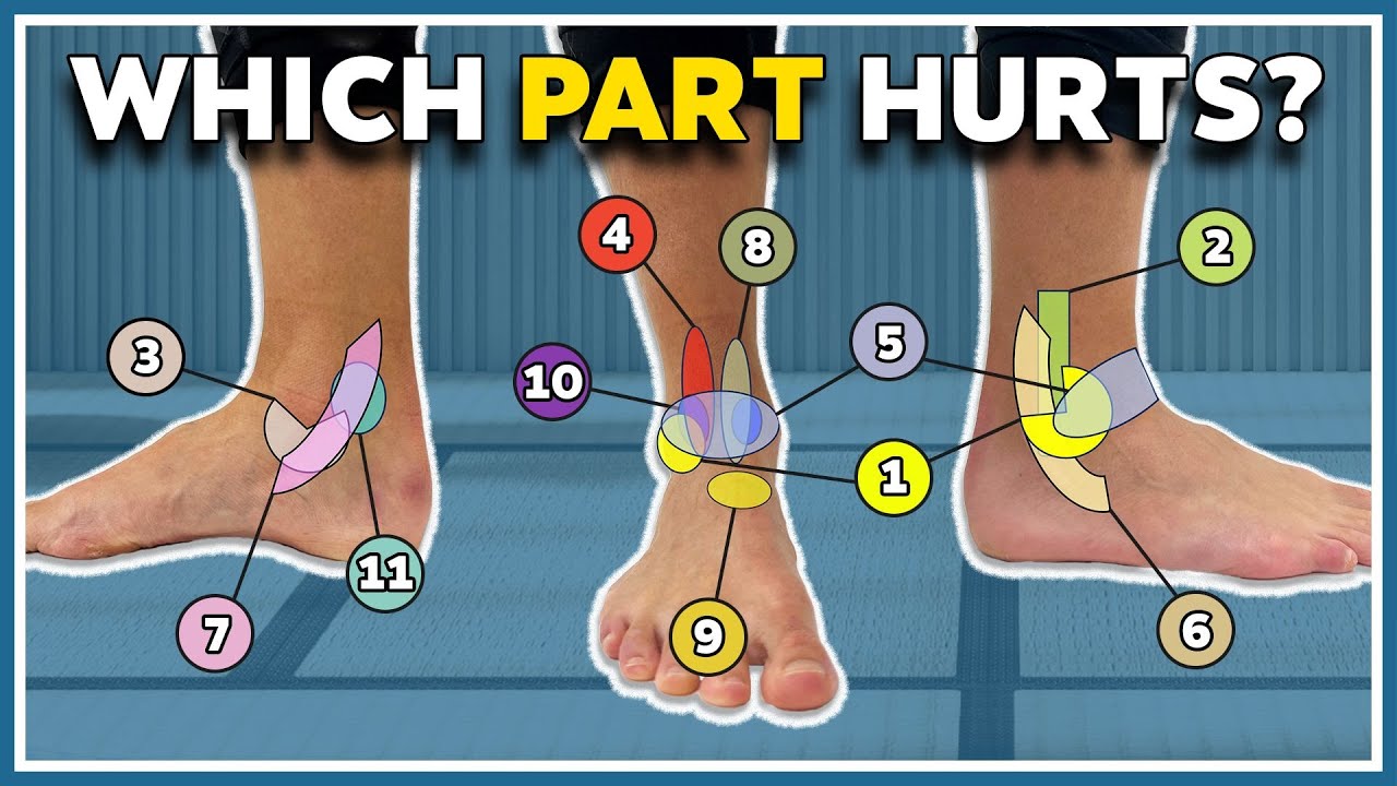 Orthopedics: How Do I Treat Heel Pain? - Warner Orthopedics