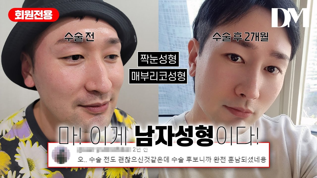 38세 부산싸나이! 멋짐이란게 폭팔한다!! 메부리코+짝짝이눈 #매부리코 #짝눈 #부산