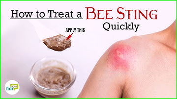Bee Sting Treatment (This Works - Instant Relief!)