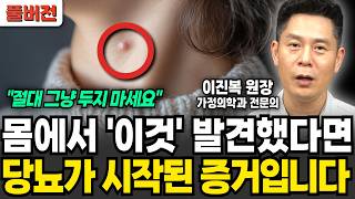 몸에서 '이것' 발견했다면 당뇨가 시작된 증거입니다 (이진복 원장 / 풀버전)