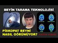 Teknolojik Bir Devrim! Beynin İçini Görmek ve İnsanı Anlamak