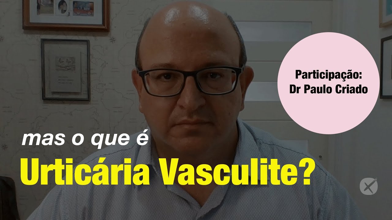 Urticária Vasculite
