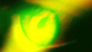 That look in your eyes (Teaser)