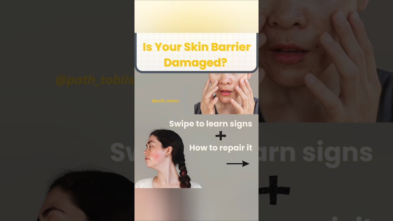 What is Skin Barrier? 