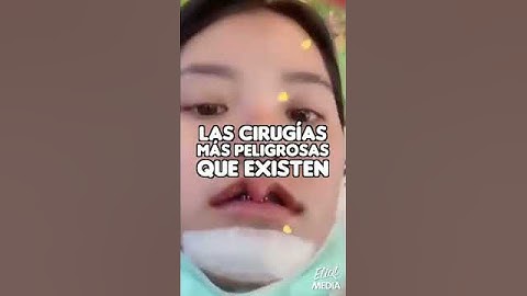 LAS CIRUGÍAS MÁS PELIGROSAS QUE EXISTEN EN EL MUNDO #Shorts
