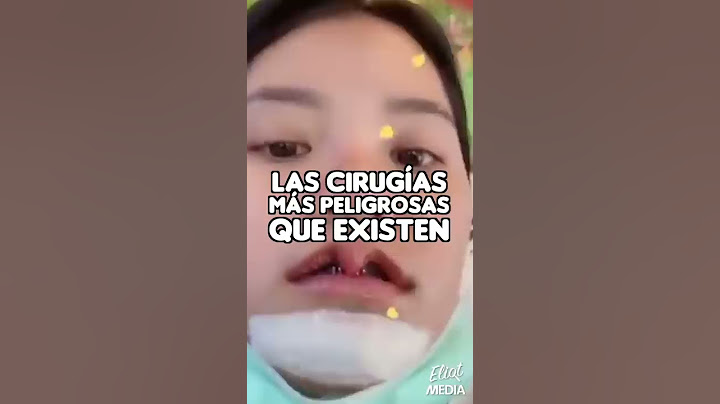 LAS CIRUGÍAS MÁS PELIGROSAS QUE EXISTEN EN EL MUNDO #Shorts