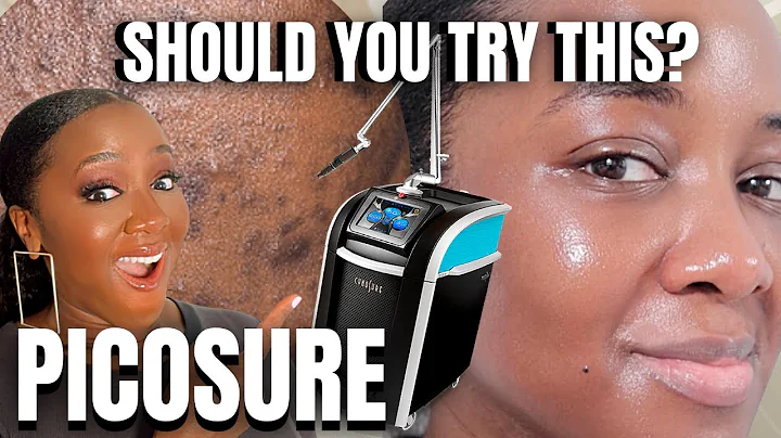 PicoSure: Bet You Haven't Tried *THIS* for Hyperpigmentation