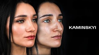 Rhinoplasty. Preparation for the surgery / KAMINSKYI