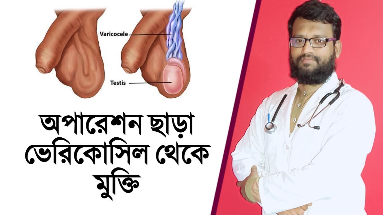 ভেরিকোসিলের কার্যকরী হোমিও বায়োকেমিক ঔষধ | varicocele homeopathy biochemic medicine in bengali