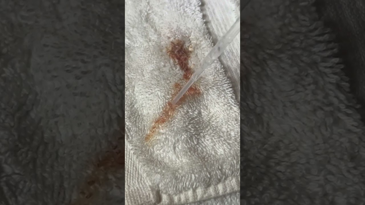 Removing blood from a towel