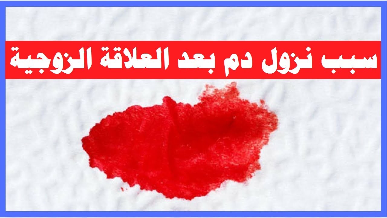 اسباب نزول دم بعد العلاقة الزوجية وهل يدل على حمل و سبب نزول دم قبل الدورة Youtube