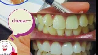 Zoomreal Kit2 - 兩週牙齒吱吱美白劑 7支裝 Two Weeks Teeth Whitening Program