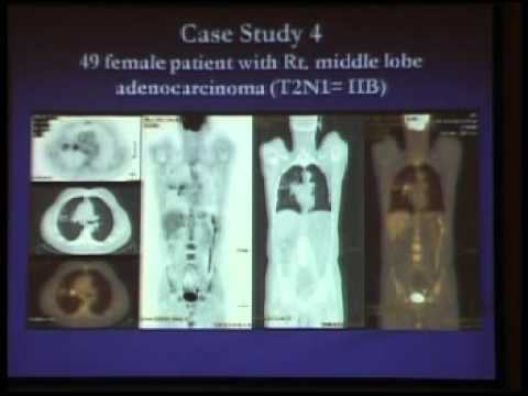 ESNMS 2010 Prof Khaled Taalab