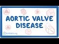 Aortic valve disease - causes, symptoms, diagnosis, treatment, pathology