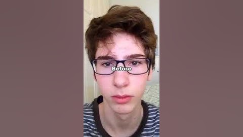 power of mewing 😮subscribe for more❤ #transformation #glowup #tiktok #mewing #shorts #shortsfeed
