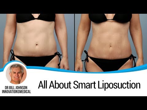 Austin Liposuction