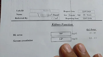 تحليل creatinine