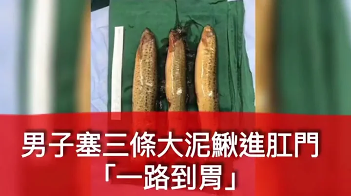 報廢聞 | 男塞3條泥鰍進肛門「一步到胃」 - 天天要聞