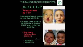 CLEFT TREATMENT AT THE TAMALE TEACHING HOSPITAL