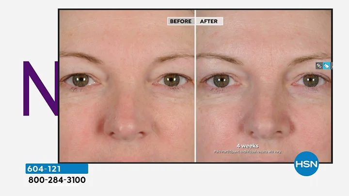 NassifMD Peri Orbital Eye Complex Duo